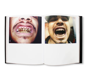 Mouth Full Of Golds (Second Edition)